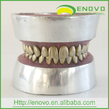 EN-E11 Metal Teeth Tooth Extraction Practice Model for Doctor Preoperative Practise